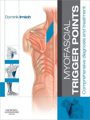cover image of Myofascial Trigger Points